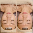 약손명가 에스테틱 (산본점) | 산본에스테틱 1회 관리만으로 살아난 턱 라인, 약손명가 산본점 동안얼굴관리