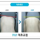 척추교정 이미지