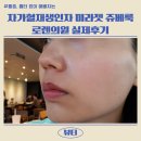 통증, 흉터없이 예뻐지는 자가혈재생인자 미라젯 쥬베룩 로렌의원 실제후기