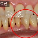다이아스 이미지