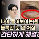 눈 밑 처짐. 눈 밑이 불룩해지는 이유. 돈 안 들이고 좋아지는 방법. 이미지