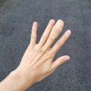 울산 동구 가나 정형외과 손가락 꿰매고 온 후기