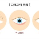 서울아이센터안과의원 이미지