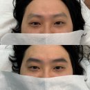 초잉브로우