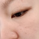 씨앤씨 | 서초피부관리 '씨앤씨뷰티' 에서 리프테라 받고온 후기(feat. 웨딩관리)