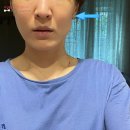 프라임21 | 울쎄라 프라임 300샷 가격 유지기간 효과 후기