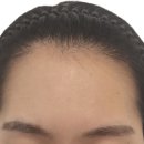 헤어라인 이미지