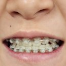 서울아이편해치과의원 네이버블로그