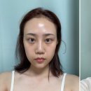 유니풀의원 이미지