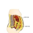 내장지방 내장지방 빼는 법 내장지방 분해에 좋은 약초 이미지