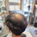 우정동미용실&위그(wig) | 부산 남자가발 완벽한 모모쌀롱 헤어앤위그 온천장본점