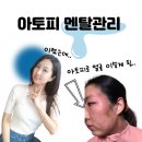 옛날한의원 | 아토피 한의원 부작용?? 한의원 다니면서 피부과 갔던 이야기(아토피 멘탈관리)