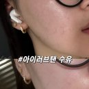 [수유] 수유역 화이트태닝 추천 | 수유 태닝샵 아이러브탠 3회차 후기