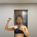 (주)팻라인 | 👗 팔살빼는방법 | 이오팻주사 | 드레스라인