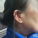 독일보청기 광주,전남센터 이미지