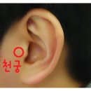 증평보청기 이미지