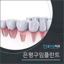 은평타임치과의원 이미지