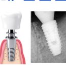 연세인스타일치과의원 이미지