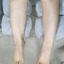 문제성발톱 해결은 부천 어딕션네일스 에서 ^^ Diego Fuss 본점!! 발톱 무좀해결! 붓기해결 종아리순환...
