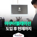 아쿠아블레이션 워터젯 기술 활용한 로봇 수술 실제 후기