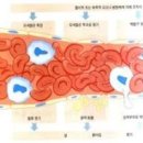 급성염증 만성염증 증상 치료방법 예방하기 이미지