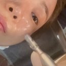 힐스킨 | 부산서면피부과 유스힐 스킨부스터 1주일 후기