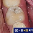 서울예봄치과 이미지