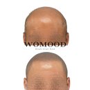 다솔디자인 - 성남시 수정구 공원로445번길 5 | 전주헤어라인 고민하다 웨딩촬영 전에 받고 온 후기