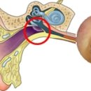 스크랩] 이명 (Tinnitus)ㅡ이루증 이미지