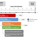 HAH (JUST4U 2.0) | Ocular Therapeutix (Nasdaq: OCUL) 분석