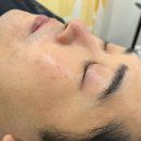라디브로우