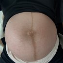 오만가지 | 안양 봄빛병원 39주 제왕절개 1일차 후기 알려줄게(수술,입원과정 절차)