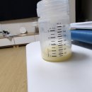 삼성건강약국 | 제왕절개 통증 후기 7일차, 8일차, 9일차(w/강북삼성병원 외래진료까지)