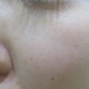 임마누엘피부과의원 | 행신동 더마드롭 <TDA> 무통증시술 피부관리 받고 왔어요! (feat. 물광피부)