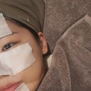 플래뉴의원 | [강남피부과] 피코토닝 / 클리어코코 받은 솔직 후기 모공 줄이는 시술ㅣ강남 플래뉴의원
