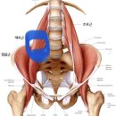 장요근 풀고서 하복부 통증 감소 이미지