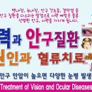 안구 건조 - 시력과 안구 질환의 원인과 치료. 이미지