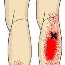 보성한의원 이미지