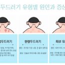 피부묘기증 겨울철 한랭두드러기 원인과 증상 이미지