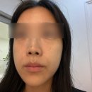 메디퍼스트 | 노원역 피부관리 퍼스트메디스킨 재방문! 칙칙한 안색 환하게 밝혀준 맞춤 미백 톤업 케어