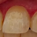 서울이채움치과의원 | 강남구 서울이채움치과의원 추천 65세이상임플란트지원 종류가격예약 알아보기