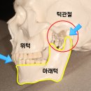 봉양미소치과의원 | 이갈이 치과 치료법 가격 후기(아내 이갈이 고친 치과의사 작성)
