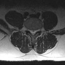 엠알아이 이미지