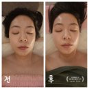 다뭉쳐봐 | 노원웨딩관리 박미정에스테틱 솔직 후기