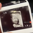 하나정밀 | 29주 정밀초음파 후기｜우리 아기가 방긋 웃어준 날💛