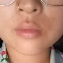 섬세한사랑니치과의원 이미지