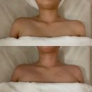 강남구청(강남메디컬투어센터) | 예신관리 웨딩드레스라인관리 추천 : 강남구청 빼라리슬리밍센터 후기