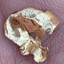 동탄센트럴치과병원 | 🦷 동탄역센트럴치과 인레이 빠짐 &amp; 치료 후기 1탄 ✨ (크라운 vs 인레이 고민)