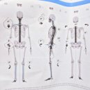 ㈜참바른건물위생관리 | 대전 재활pt 리커버바른몸센터에서 체형교정 받고 온 생생 후기