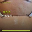 라포체형관리